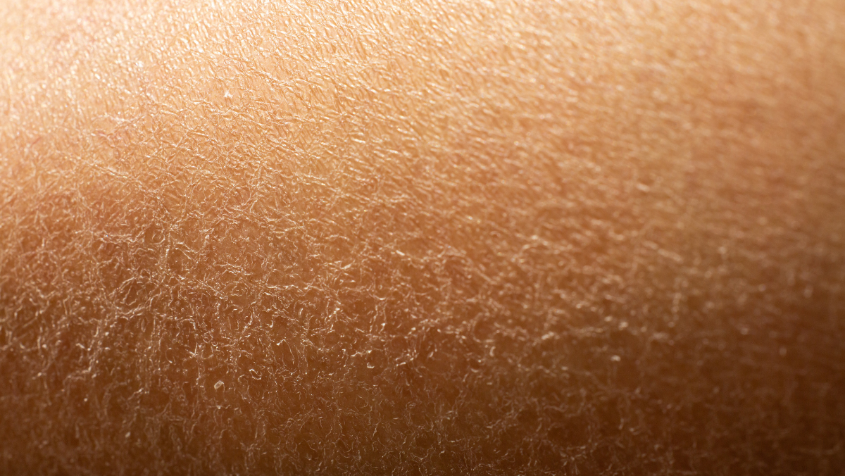 A bőrszárazság okai – és mit tehetsz ellene hatékonyan?